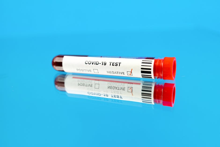 Illustration depicting a medical professional performing diagnostic tests for Diabetic Ketoacidosis (DKA) with a blood sample and urine sample.