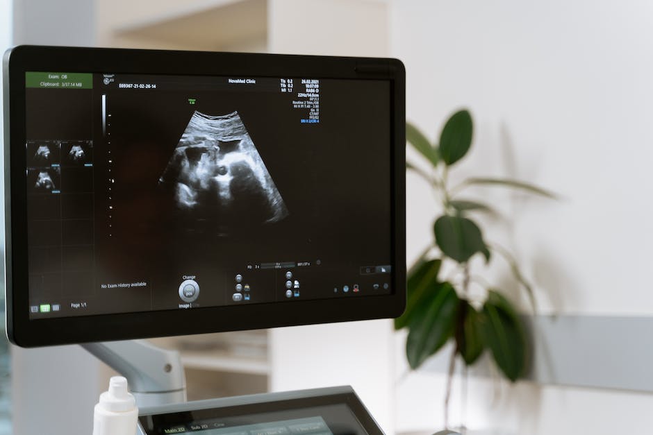 Ultrasound image showing the nuchal translucency area at the back of the baby's neck, used in the nuchal translucency test