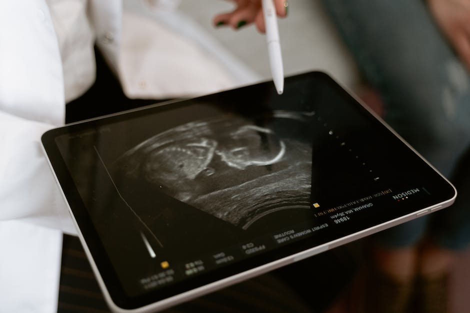 Illustration of a pregnant woman undergoing a prenatal screening test