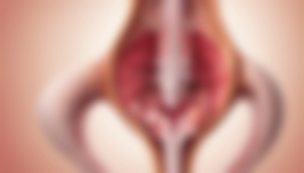 Illustration of a retroverted uterus showing its orientation in the pelvis.