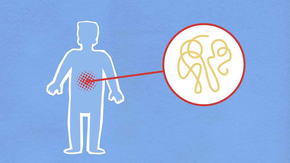 Illustration of joints affected by gout with redness and swelling